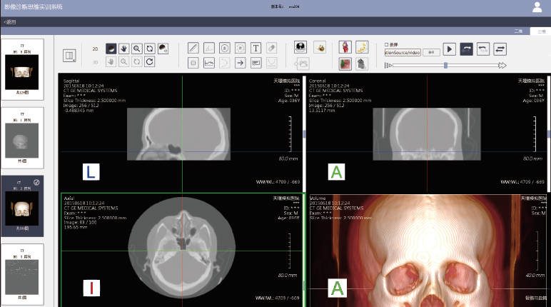 影像診斷思維實(shí)訓(xùn)系統(tǒng)